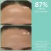 APIVITA JUST BEE CLEAR PORE MINIMIZING PURIFYING LOTION 200ML