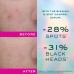 NUXE ZINC POWER BLEMISH AND SPOT CONTROL SERUM 30ML